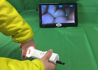 X 1.5 Độ phóng đại kỹ thuật số điện tử Soi Cổ Tử Cung kết nối với TV hoặc máy tính hoặc y tế Monitor cho sức khỏe của phụ nữ