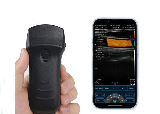 Máy quét bàng quang siêu âm cầm tay Wifi 305mm Đầu dò lồi + tuyến tính + tim