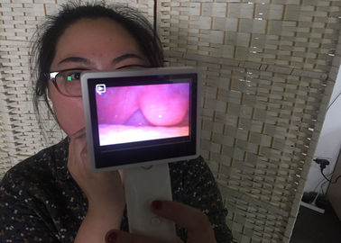 Máy nội soi tai mũi họng ENT Máy quay video y tế Máy soi tai kỹ thuật số để kiểm tra mũi bằng màn hình LCD