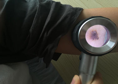 Tùy chỉnh Chăm sóc sức khỏe Cầm tay Y tế Dermatoscope Digital Video Kiến soi tai để kiểm tra da