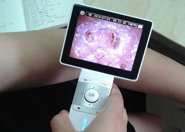 Da cầm tay Và Phân tích tóc video Dermatoscope Với 3,5 Inch LCD đầy màu sắc