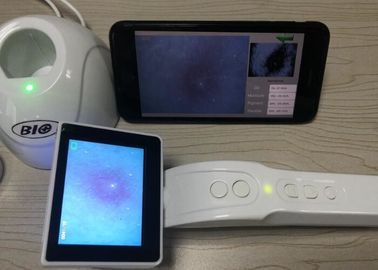 Máy dò da và da đầu Video Dermatoscope với Báo cáo phân tích về độ ẩm dầu sắc tố linh hoạt