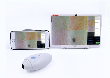 HD Digital Dermatoscope Skin Hair Scanner Wireless Kết nối với Mobilophone được hỗ trợ IOS Android