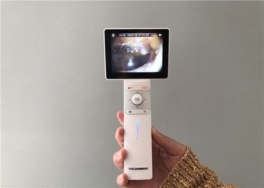 Micro SD Card USB Ear Camera Kỹ thuật số video Hình ảnh tổng quát Hình ảnh và Dermatoscope