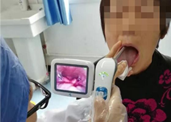Kiểm tra tai mũi họng kỹ thuật số y tế Máy soi tai qua video cầm tay với màn hình LCD 3 inch