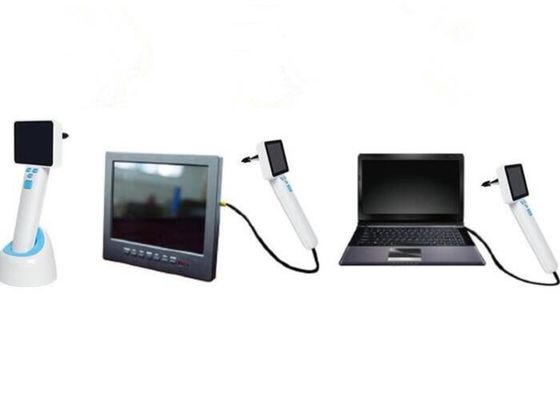 4 Đèn LED trắng tự nhiên Y tế Video Nội soi Tai mũi họng USB với Hình ảnh được Lưu trữ trong Máy tính Đường kính Nhỏ gọn 0,5cm