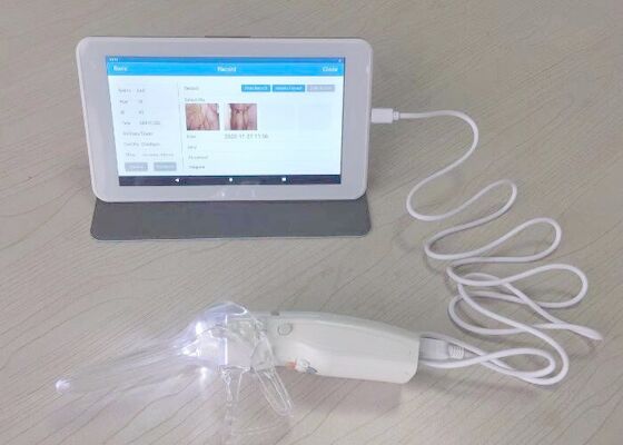 Video Soi Cổ Tử Cung Digital cho phụ nữ Chăm sóc 10 hoặc 7 Inch y tế Monitor Máy ảnh chuyên nghiệp cho Thanh tra cổ tử cung