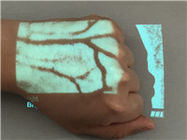 Hiển thị tĩnh mạch chính xác Thời gian thực Máy dò tĩnh mạch hồng ngoại cầm tay với 2 màu Hình ảnh có thể điều chỉnh