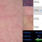 Wifi Skin and Scalp Tester Máy phân tích da không dây kỹ thuật số với màn hình 8 &quot;Hiển thị hình ảnh 9