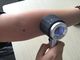 Độ chính xác cao Magnifier quang 10 lần Dermatoscope da Analyer Sử dụng 2 * AA số 5 Pin kim loại thủy tinh quang học Ống kính