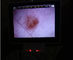 Màn hình LCD Digital Video kiến ​​soi tai kính soi đáy mắt Đối với Thanh tra lâm sàng Trong cơ thể người