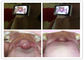 Thẻ nhớ Micro SD Thiết bị kiểm tra tai kỹ thuật số Ống kính hình ảnh chung để kiểm tra cổ họng