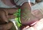 Hệ thống hiển thị tĩnh mạch Công cụ tìm tĩnh mạch hồng ngoại Thiết bị định vị Transilluminator Trình xem tĩnh mạch cho trẻ em