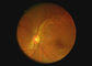 Thiết bị quang học Họng mắt Máy ảnh video Máy soi tai Dermatoscope Nội soi kỹ thuật số với 2 triệu pixel