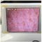 Kiểm tra độ ẩm da trắng Wifi Cảm biến độ ẩm da với hiển thị hình ảnh trong Ipad