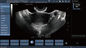 Thăm dò siêu âm Doppler màu di động cho thai kỳ