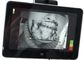 Nâng cấp phiên bản tìm kiếm tĩnh mạch hồng ngoại không liên lạc 850nm cho hình ảnh camera hồng ngoại tĩnh mạch