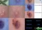 Máy dò da và da đầu Video Dermatoscope với Báo cáo phân tích về độ ẩm dầu sắc tố linh hoạt