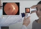 Hệ thống đo quang cơ di động cầm tay Máy ảnh kỹ thuật số Fundus với ống kính 1080P độ nét cao Có sẵn thuốc điều trị từ xa