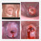 Máy ảnh kỹ thuật số âm đạo điện tử Soi Cổ Tử Cung để tìm bệnh của cổ tử cung Eealier