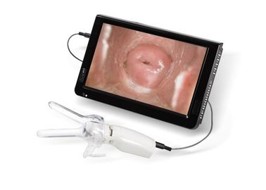 Kính soi cổ tử cung nhỏ để chụp ảnh cổ tử cung Máy ảnh âm đạo được kết nối với TV hoặc PC