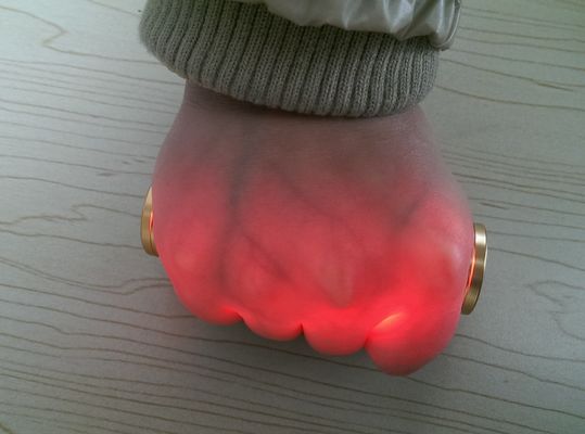 Máy chụp X-Quang Thiết Bị Đường Vây Ánh Sáng