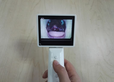 Lưu trữ thẻ SD Thiết bị chẩn đoán ENT Máy soi đáy mắt tự động bằng cáp USB