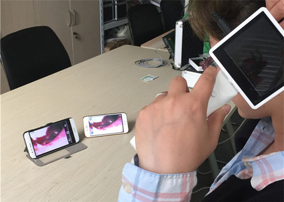 Ống soi tai kỹ thuật số 720X480