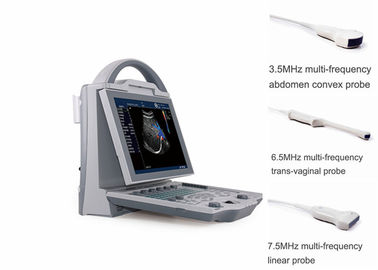 Máy quét siêu âm thai kỳ mang máy có transduag truyền qua lưỡi liềm bụng
