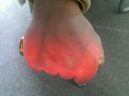 Máy chụp X-Quang Thiết Bị Đường Vây Ánh Sáng