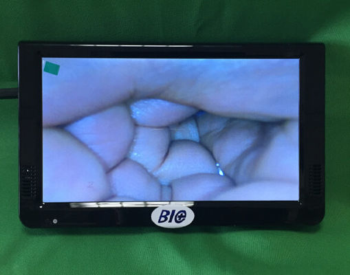 Máy soi cổ tử cung điện tử kỹ thuật số di động