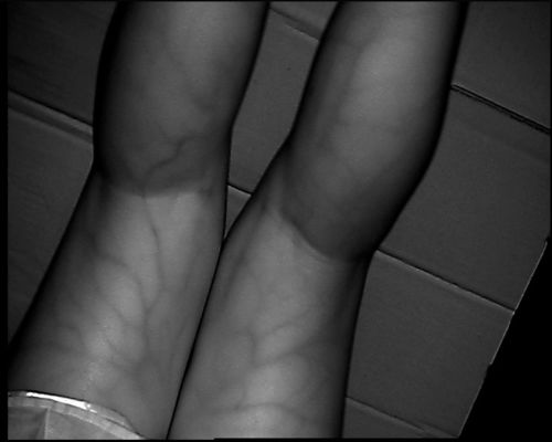 Độ phân giải cao 800X480 Loại bảng Vein Locator Device Với Màn hình 3,5 inch dành cho chân tay