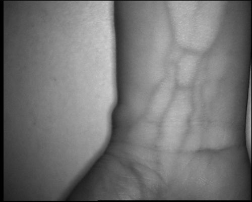 Độ phân giải cao 800X480 Loại bảng Vein Locator Device Với Màn hình 3,5 inch dành cho chân tay