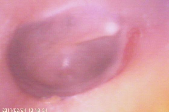 Ống soi tai kỹ thuật số 720X480