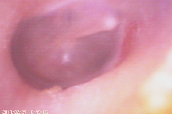 Ống soi tai kỹ thuật số 720X480