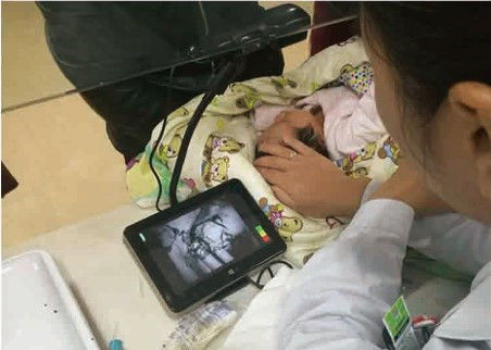 Công cụ tìm tĩnh mạch hồng ngoại kinh tế di động phát hiện khoảng 10 mm độ sâu của xe đẩy có sẵn