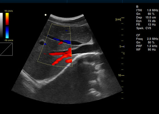 Máy Doppler màu kỹ thuật số đầy đủ 15 inch Siêu âm Doppler hình ảnh di động với 2 cổng USB