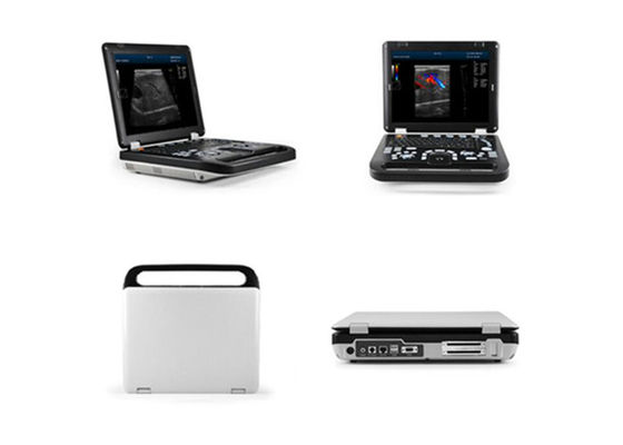 Máy quét siêu âm chẩn đoán con người 15 inch với một kết nối đầu dò và hai cổng USB