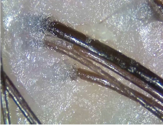 Máy phân tích da kỹ thuật số không dây di động Thiết bị chẩn đoán từ xa với ánh sáng phân cực