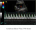 Thiết bị chẩn đoán siêu âm Ipad Máy quét siêu âm cầm tay với lưu trữ hình ảnh 500G