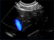 Máy quét siêu âm cầm tay Mini Pocket