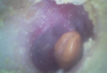 Tai mũi họng di động Phạm vi kinh tế Máy soi tai video kỹ thuật số cầm tay với thẻ nhớ Micro SD Flash 32G