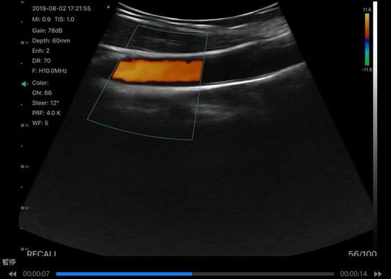 Máy quét siêu âm cầm tay không dây số