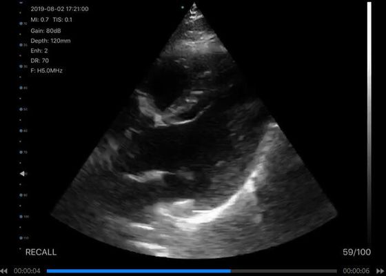 Máy quét siêu âm cầm tay không dây số