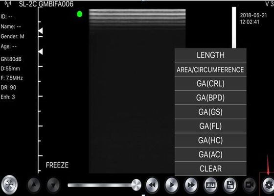 Máy quét siêu âm cầm tay 5G Lồi: 3,5 ~ 5MHz, Tuyến tính: 7,5 ~ 10MHz, Tim mạch: 2,5 ~ 5MHz