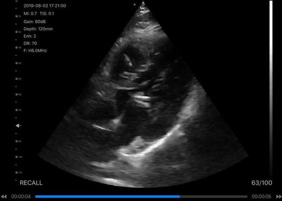 Máy quét siêu âm cầm tay 5G Lồi: 3,5 ~ 5MHz, Tuyến tính: 7,5 ~ 10MHz, Tim mạch: 2,5 ~ 5MHz