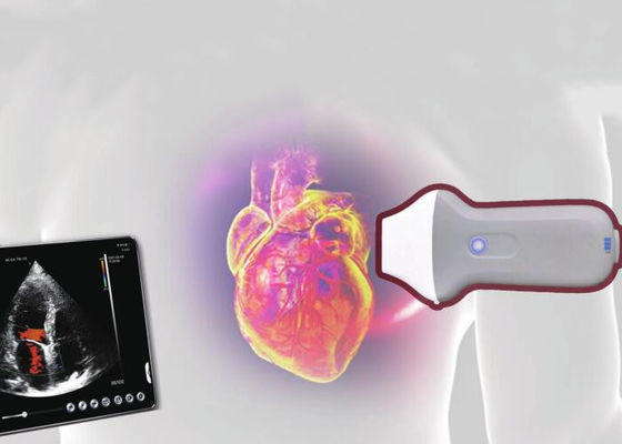 Máy quét siêu âm di động không dây PDI WiFi 128 phần tử